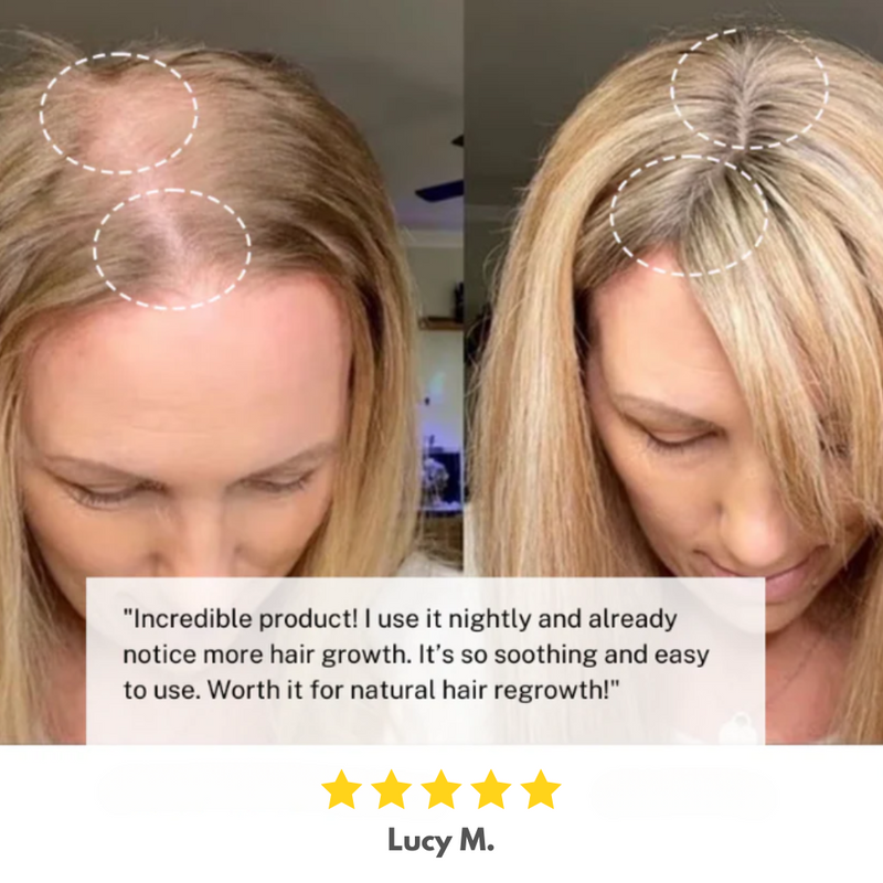 Red Light Therapy Hairbrush
